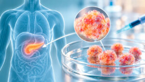 Trasplante de islotes pancreáticos en diabetes tipo 1